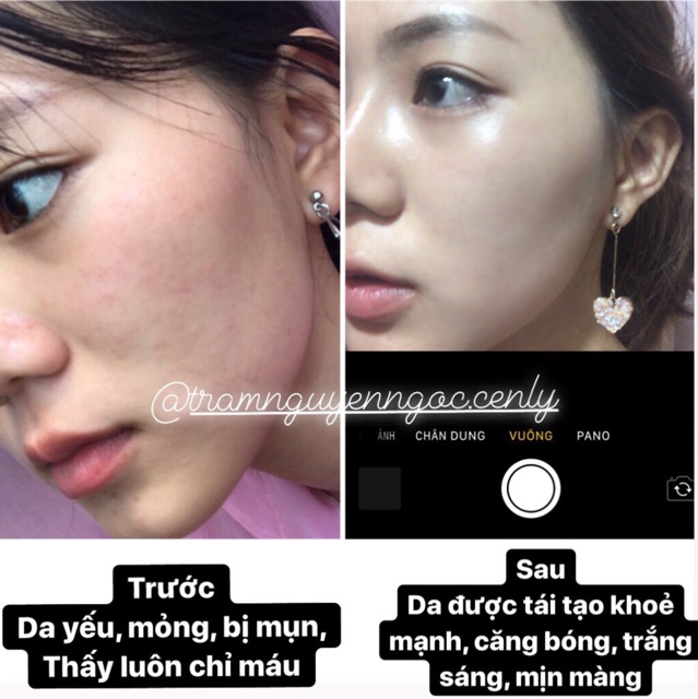 Serum Collagen Tái Tạo Da Amoliskin | BigBuy360 - bigbuy360.vn