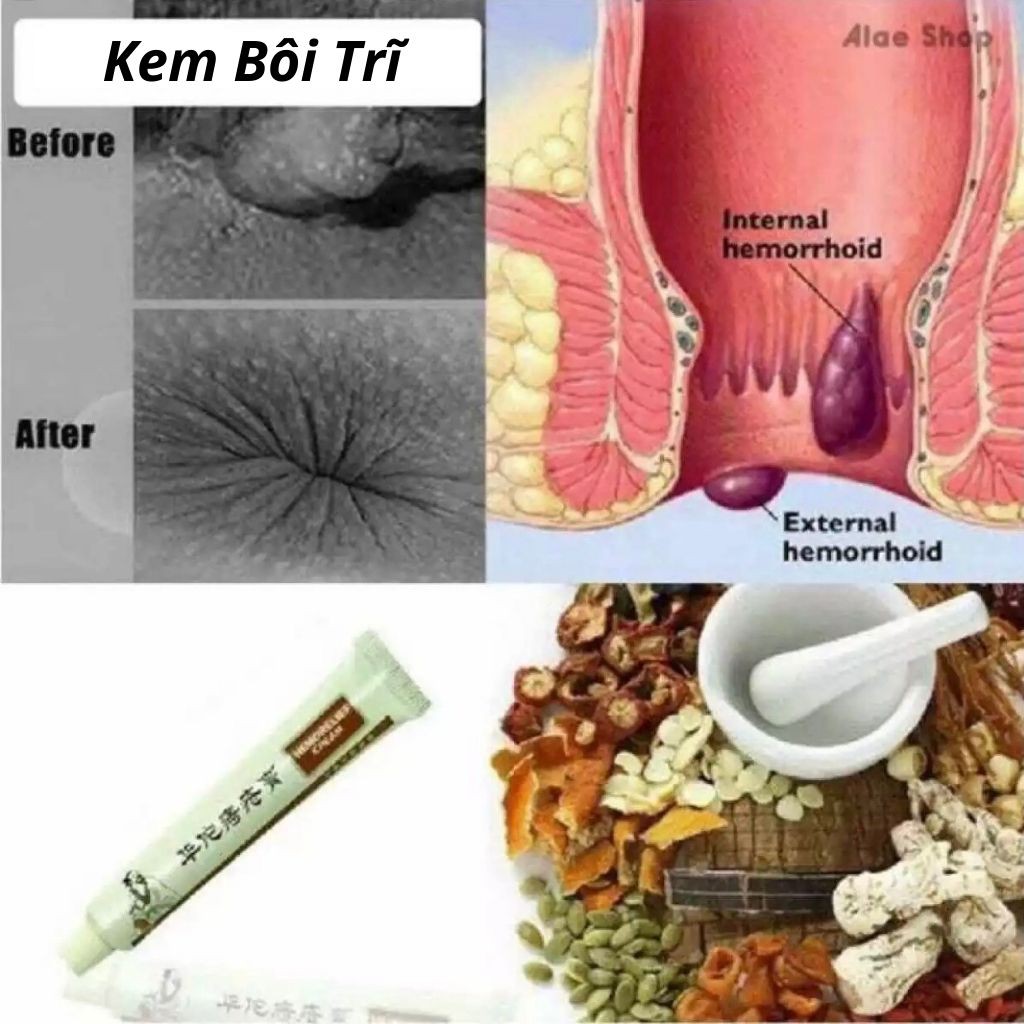 Kem Bôi Trĩ Nứt Kẽ Hậu Môn Thảo Dược Dictamni Tuýp 20gr