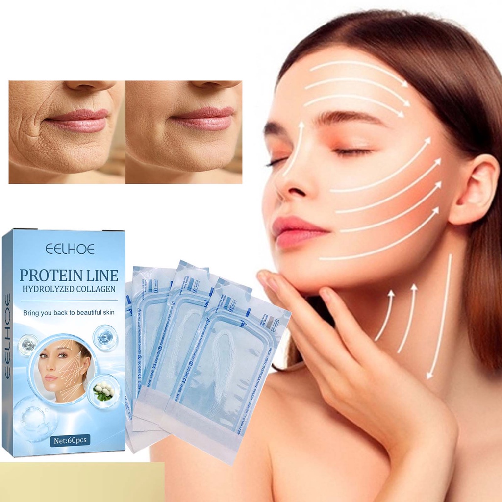 Set 60 Cuộn Chỉ Protein Lụa Không Kim Chạm Khắc Bổ Sung Collagen Chống Lão Hóa Làm Săn Chắc Da Mặt