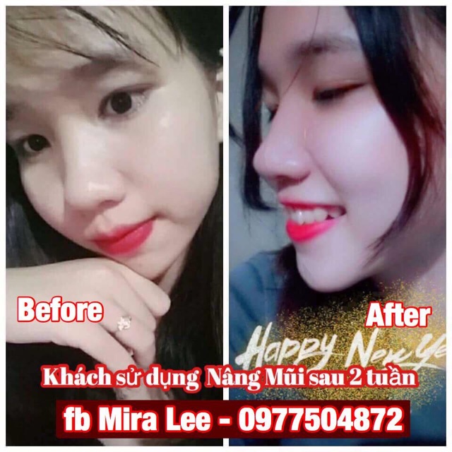 Serum Nâng Cao Mũi Hàn