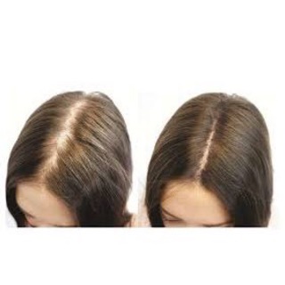 Xịt tóc tinh dầu bưởi Hair lotion