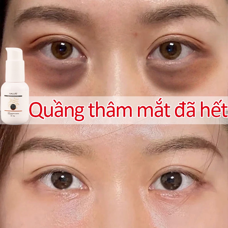 giảm thâm mắt kem dưỡng mắt quầng thâm mắt kem tan bọng mắt chống thâm mắt Kem tiêu bọng mắt serum tan bọng mắt cao cấp