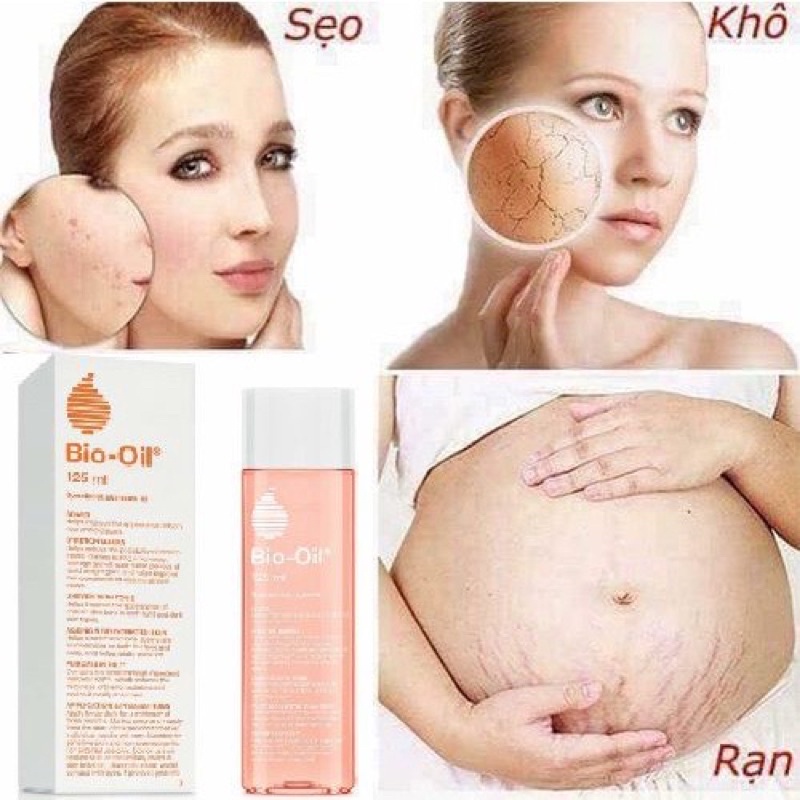 ( Chính Hãng Hoả Tốc SG ) Tinh dầu Bio Oil giảm rạn da, làm mờ sẹo cho mẹ bầu hiệu quả chai 125ML - CO100