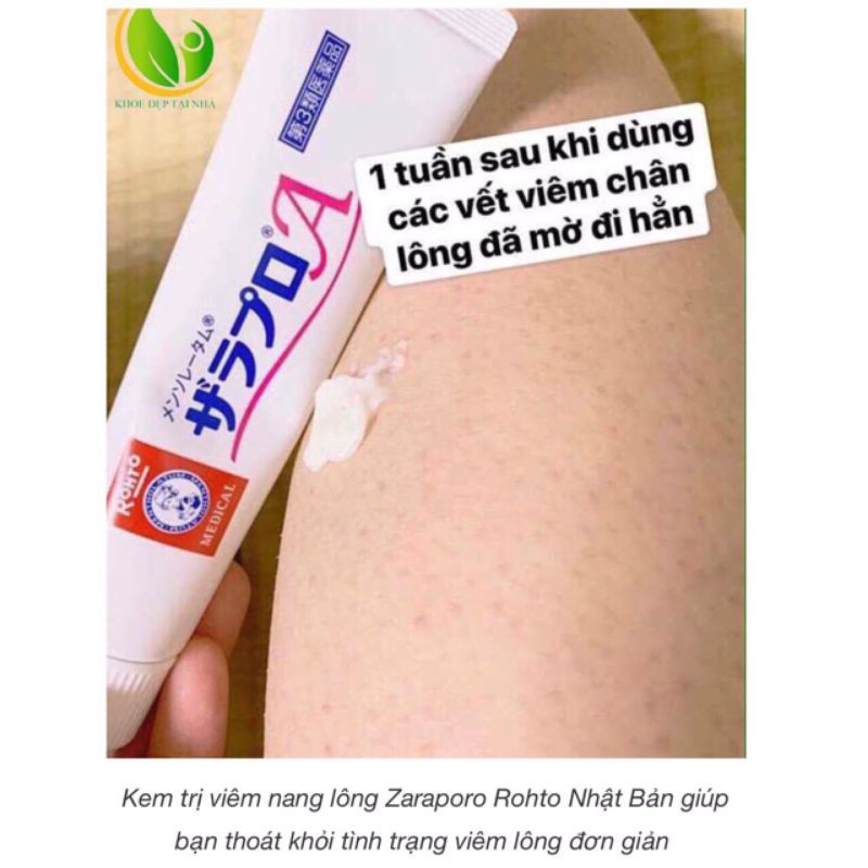 Kem bôi da Viêm Nang Lông Zaraporo Rohto Nhật Bản 35g