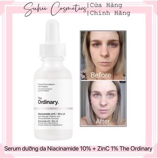 Serum the ordinary niacinamide 10% + zinc 1% 30ml