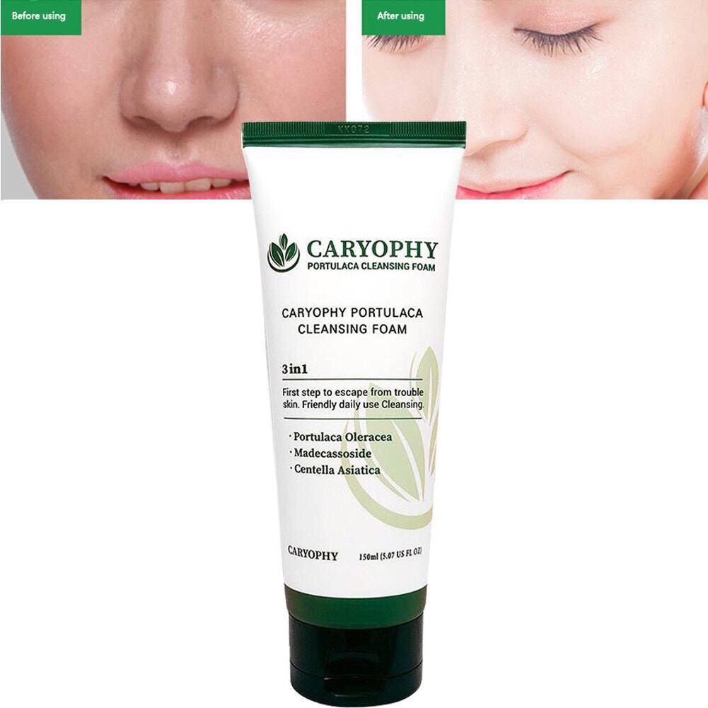 Combo Sữa Rửa Mặt + Serum Ngăn Ngừa Mụn Thâm Caryophy❤️FREESHIP❤️Ngăn Ngừa Các Loại Mụn và Thâm chính hãng Hàn Quốc | BigBuy360 - bigbuy360.vn