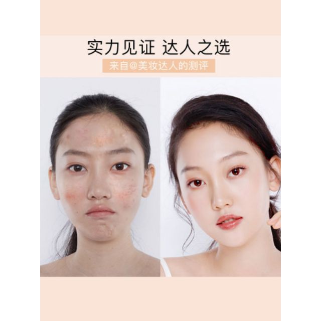 Kem nền che khuyết điểm Image kiềm dầu kháng nước lâu trôi bảo về da Zentop | BigBuy360 - bigbuy360.vn