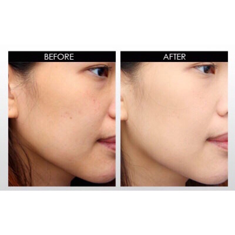 Kem truyền trắng mh spa