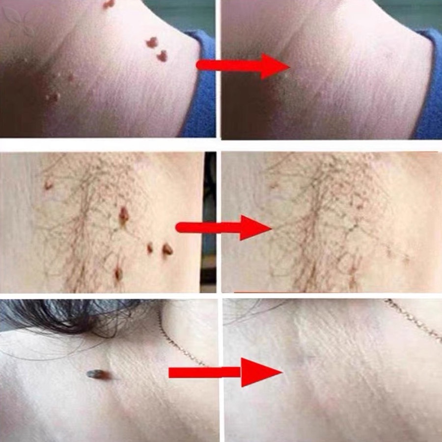 Kem Dưỡng Da Mặt JMMZ Xóa Mờ Nếp Nhăn / Mụn / Đốm Nâu Hiệu Quả