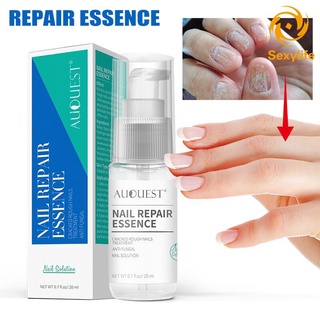 Dung dịch dưỡng móng chân chống nấm móng