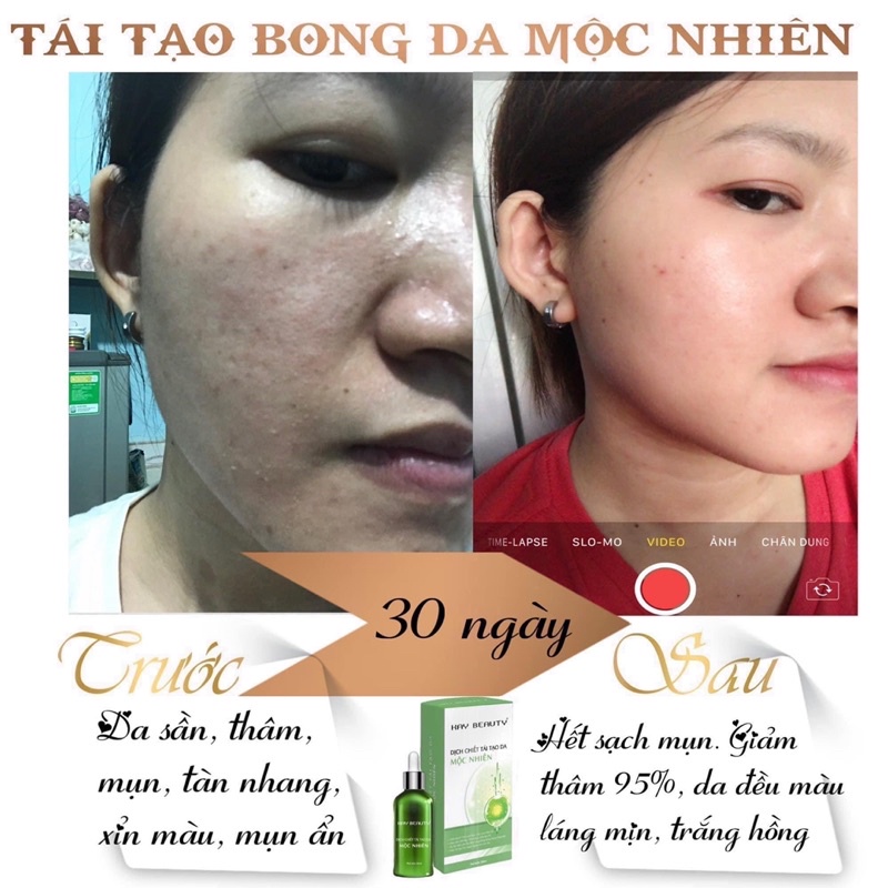 Tái tạo da mộc nhiên đông y (tặng 1 son nhung lì) | BigBuy360 - bigbuy360.vn