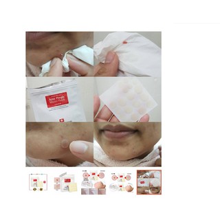 Miếng dán mụn Cosrx Acne Pimple Master Patch