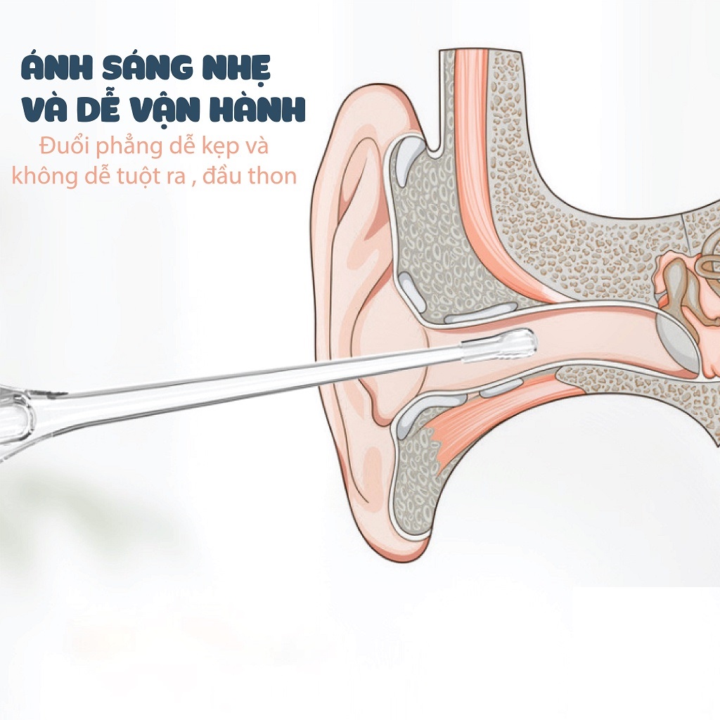 Dụng cụ lấy ráy tai cho bé có đèn, có nắp đậy giúp bảo vệ phần đầu sạch sẽ và ko bị trầy xước an toàn cho trẻ