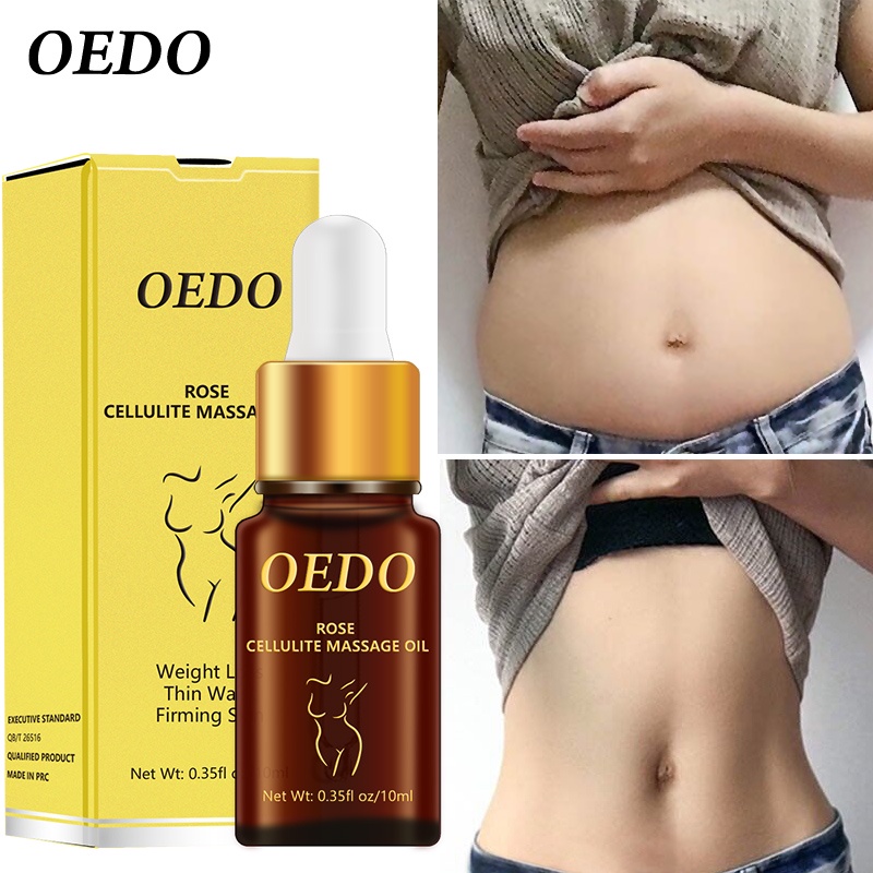 Kem massage đốt cháy mỡ thừa làm thon eo OEDO Giảm Mỡ Bụng, Đùi, Bắp Tay, Bắp Chân làm săn chắc da 10ml