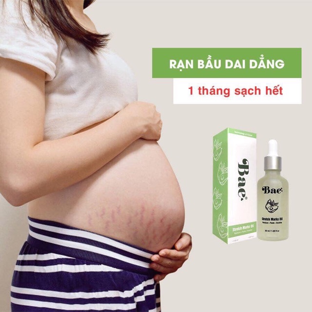 Trị rạn da cho bà bầu và sau sinh hiệu quả