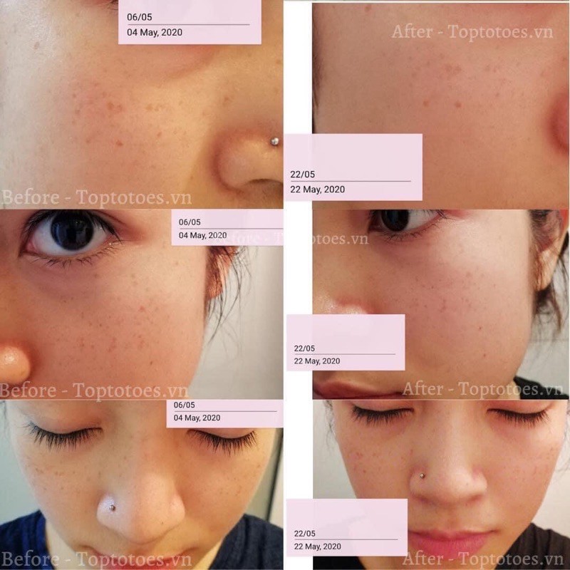 Serum Teana Super Peptides ASAP dưỡng trắng, mờ thâm, cải thiện kết cấu da | BigBuy360 - bigbuy360.vn