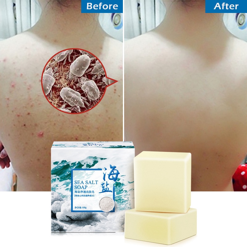 Xà phòng muối biển rửa mặt/tẩy trang/tẩy mụn đầu đen/trứng cá 100g | BigBuy360 - bigbuy360.vn