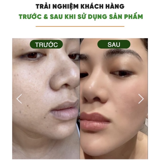 SIÊU VI TẢO GREEN VITA RECOVERY SỨC MẠNH CHỐNG LÃO HÓA ĐẾN TỪ "BÍ THUẬT" NHẬT BẢN | BigBuy360 - bigbuy360.vn