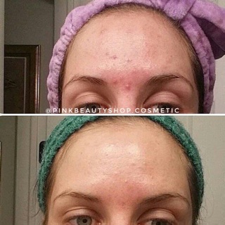Tẩy da chết Cosrx BHA