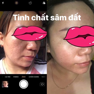 Tinh chất sâm đất