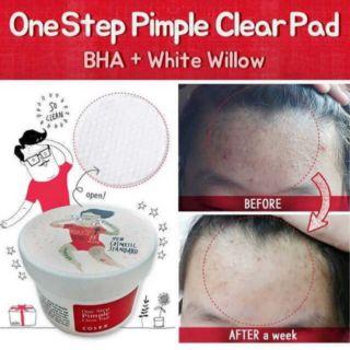 Tẩy da chết Cosrx pad đỏ da dầu mụn