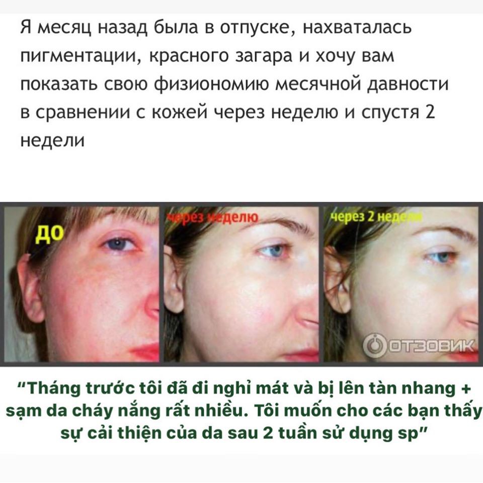 Serum Teana Blue Retinol cho da căng sáng, láng mướt, trẻ hoá da