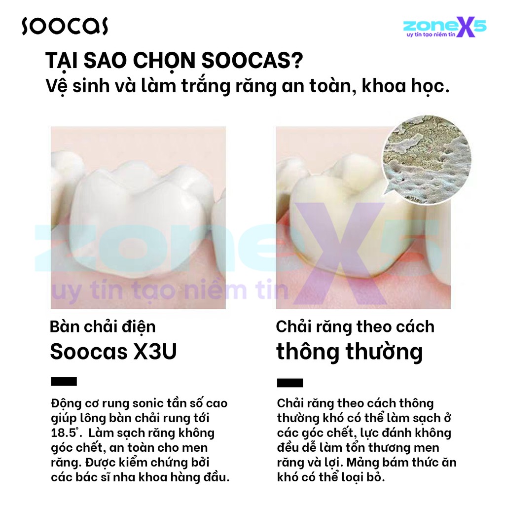 Bàn chải đánh răng siêu âm Xiaomi Soocas X3U Van Gogh - Bàn chải điện Soocas X3U rung 39600 vòng/phút, pin 30 ngày