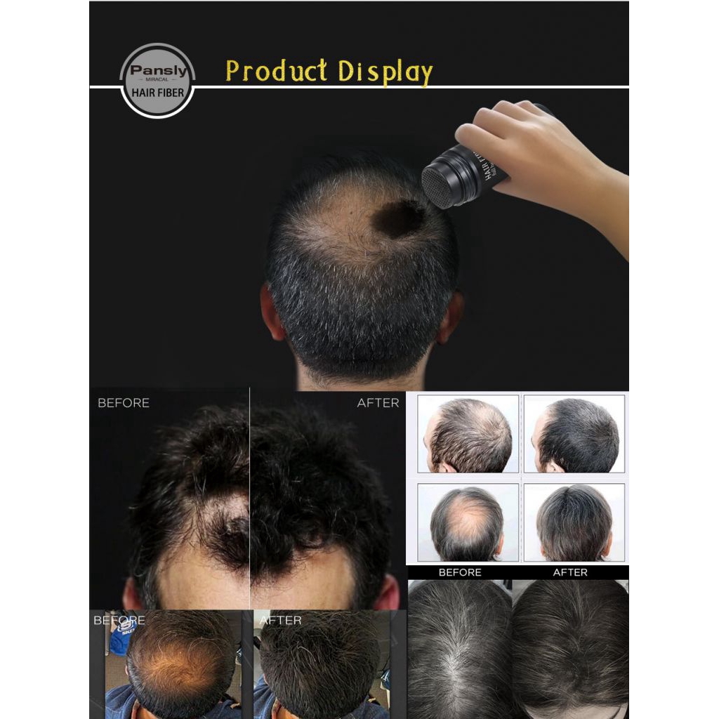 Bột che khuyết điểm, giúp làm dày tóc và chống rụng tóc hiệu quả | BigBuy360 - bigbuy360.vn