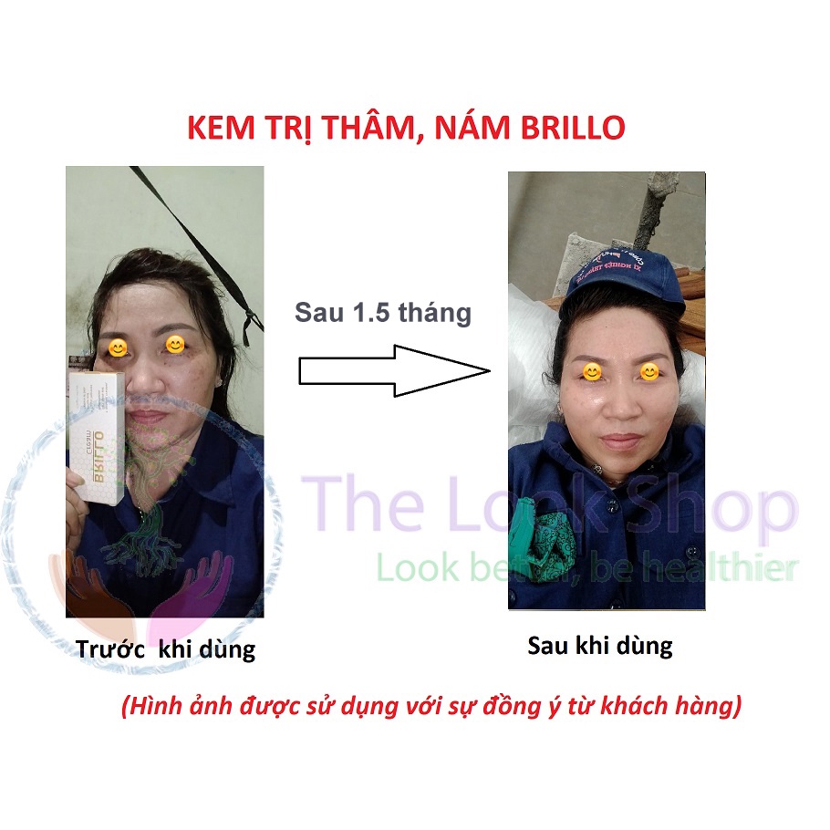 Kem dưỡng trắng da 3 trong 1 Brillo Plus 20gr- Hỗ trợ giảm nám, tàn nhang, nâng tone đều màu da- Nhập khẩu chính ngạch