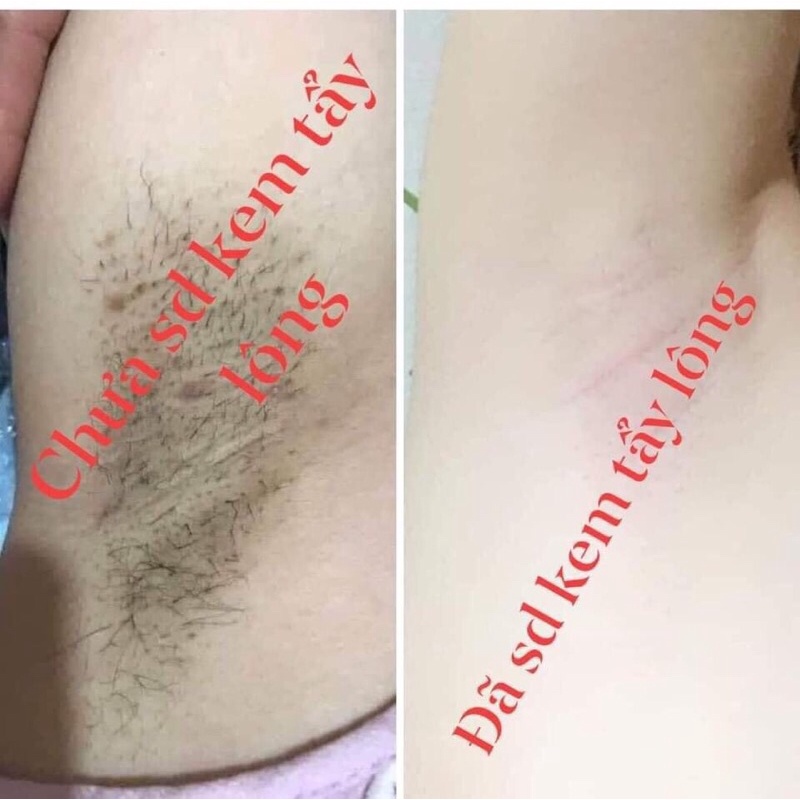 Kem tẩy lông chanh gấc, kem tẩy lông nách tại nhà an toàn, triệt lông an toàn Daimond Skin