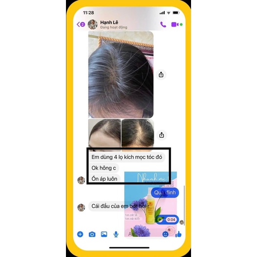 [Giá rẻ HCM] Tinh chất Sả bưởi INTINITY Tuệ Vi chính hãng kích mọc tóc , mượt tóc sau 100ml