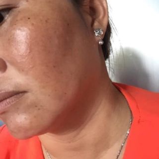 Kem Ncolagen sam