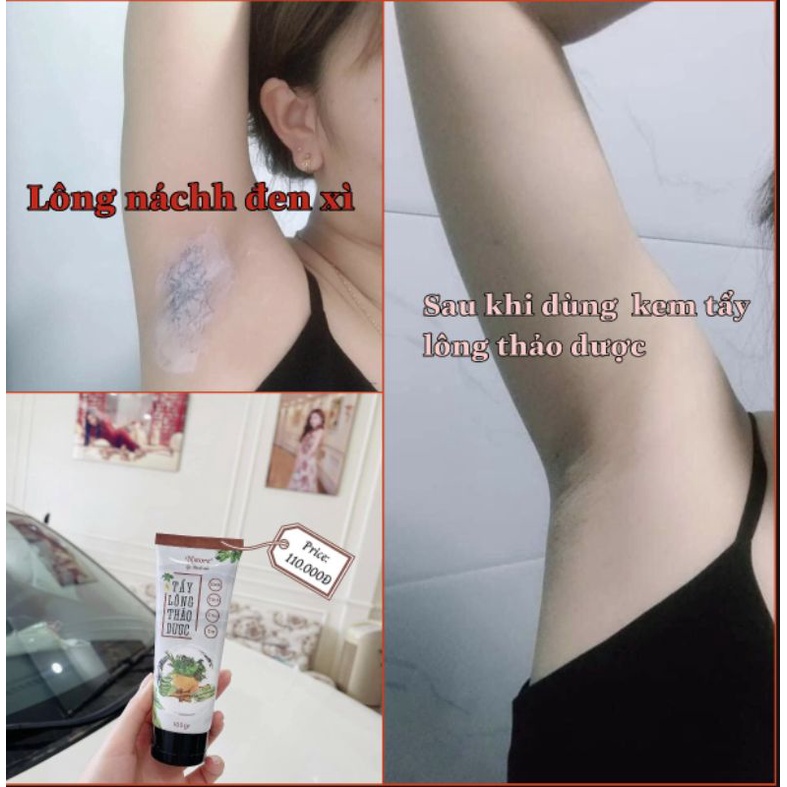 [CHÍNH Hãng] Kem Tẩy Lông Thảo Dược, Kem Tẩy Lông N'Store, Triệt Lông Vĩnh Viễn | BigBuy360 - bigbuy360.vn