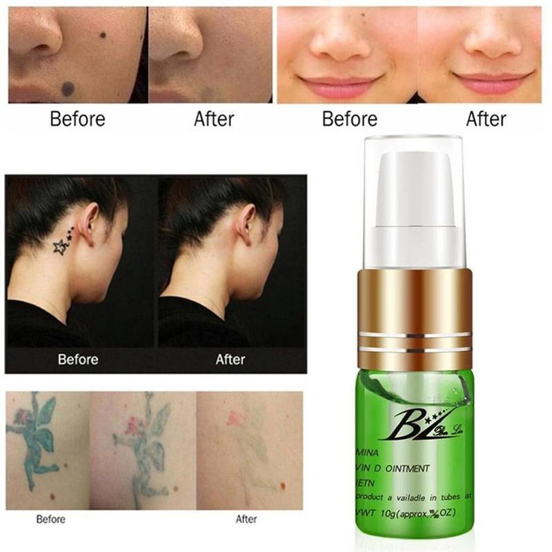 Tinh dầu xóa nốt ruồi/ hình xăm không đau 10ml