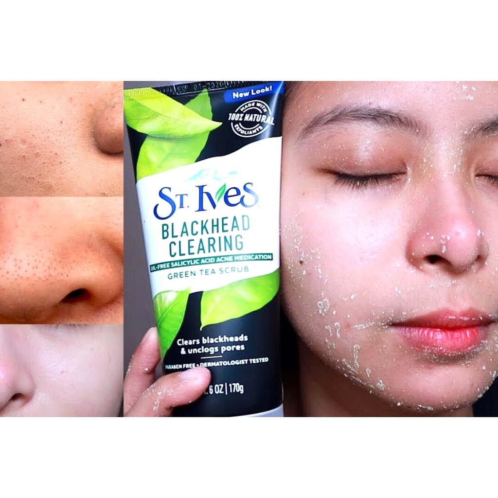 Tẩy da chết ST.Ives Blackhead Clearing Green Tea Scrub làm sạch mụn đầu đen chiết xuất trà xanh 170g - USA Chính Hãng