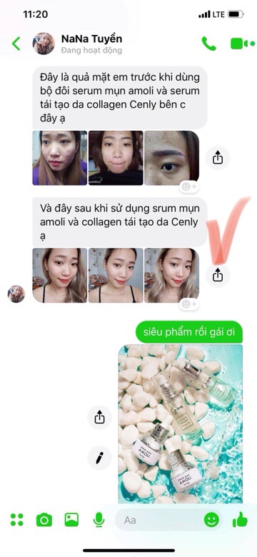 Serum Mụn Amoli | BigBuy360 - bigbuy360.vn