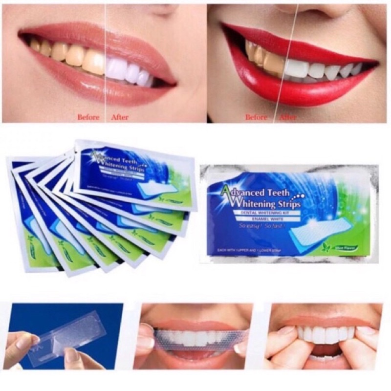 14 Gói - 28 Miếng Dán Trắng Răng Teeths Whitening Strip - Tẩy trắng răng cấp tốc tại