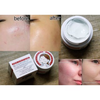 Kem trị mụn Ciracle Red Spot Cream