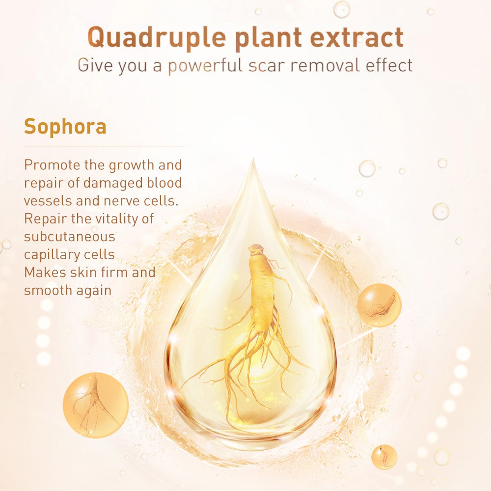 LANBENA (Hàng Mới Về) Kem Trị Sẹo Mụn Tcm Tcm Cho Nữ 30g | BigBuy360 - bigbuy360.vn