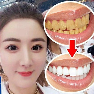 Hộp 7 miếng dán trắng răng 3D white