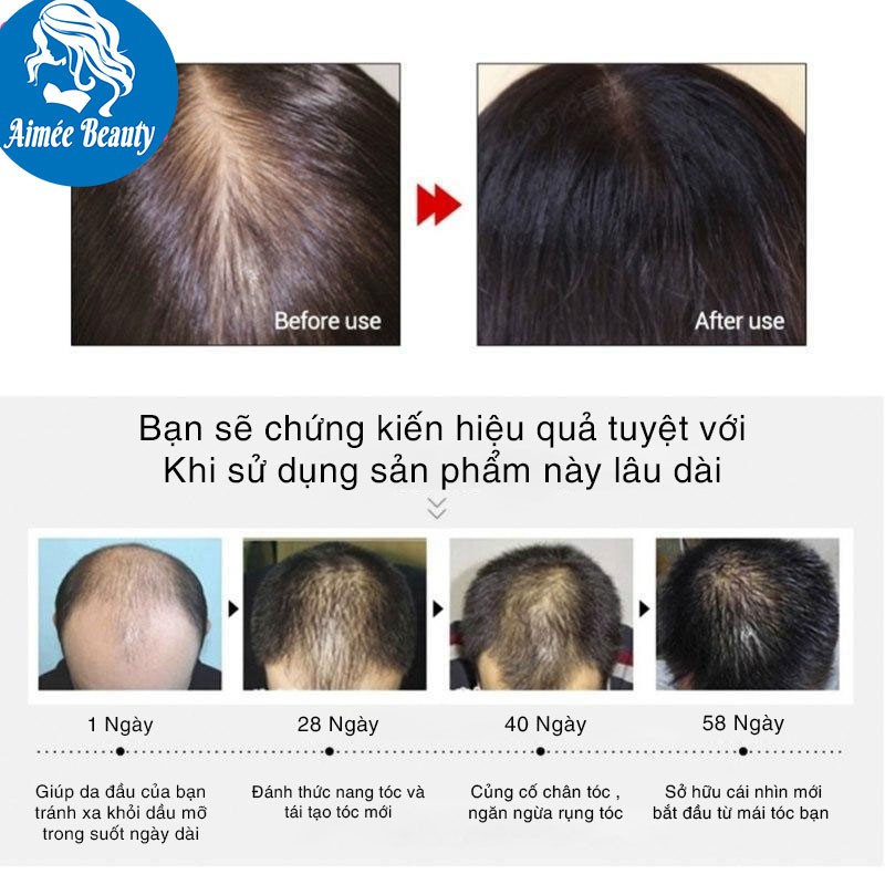 [CHÍNH HÃNG] Tinh Chất Kích Thích Mọc Tóc LanBena Giảm Gãy Rụng Dầu Gội Mọc Tóc Nhanh 20ml