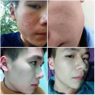 tinh chất tái tạo sắc dược