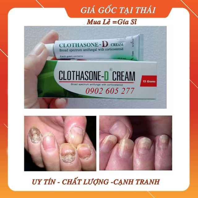 [hàng chính hãng]Tuýp Bôi Nấm Móng CLOTHASONE-D 15gr Thái Lan