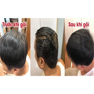 gội đen tóc -nâu tóc(hộp 10 gói)