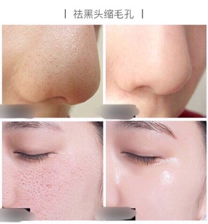 Tinh chất dưỡng shrinkage pore 30ml G204