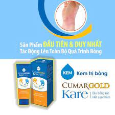 Kem Cumargold Kare 30G làm dịu trong các trường hợp bỏng, ngăn ngừa làm mờ sẹo
