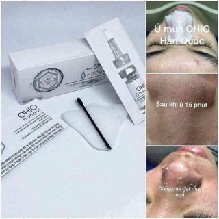 Ủ mụn ohio - hàn quốc