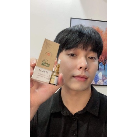 DƯỢC CHẤM MỤN ACNE(chính hãng niêm yết giá) | BigBuy360 - bigbuy360.vn