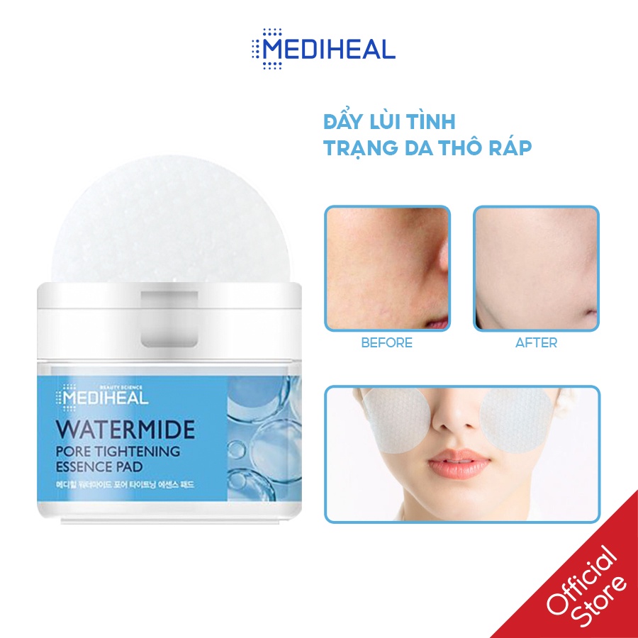 Hộp miếng đắp dưỡng ẩm và se khít lỗ chân lông Mediheal Watermide Pore Tightening Essence Pad 130ml (50 miếng)