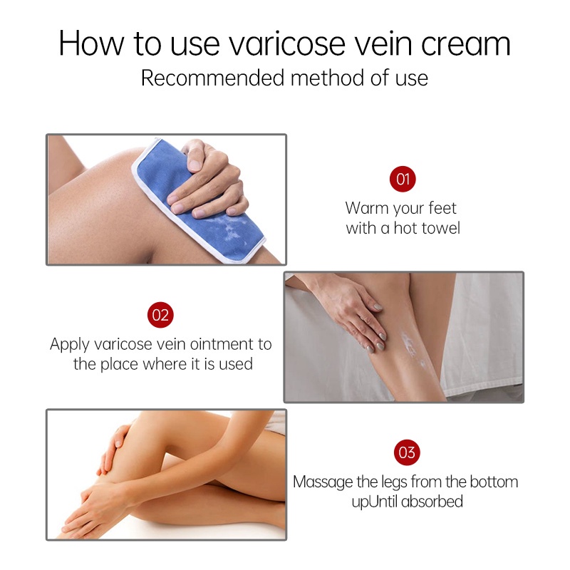 Kem Hỗ Trợ Giảm Bệnh Vảy Nến / Vảy Nến / Vảy Máu Giảm Đau Và Chăm Sóc Cơ Thể Hiệu Quả 80g